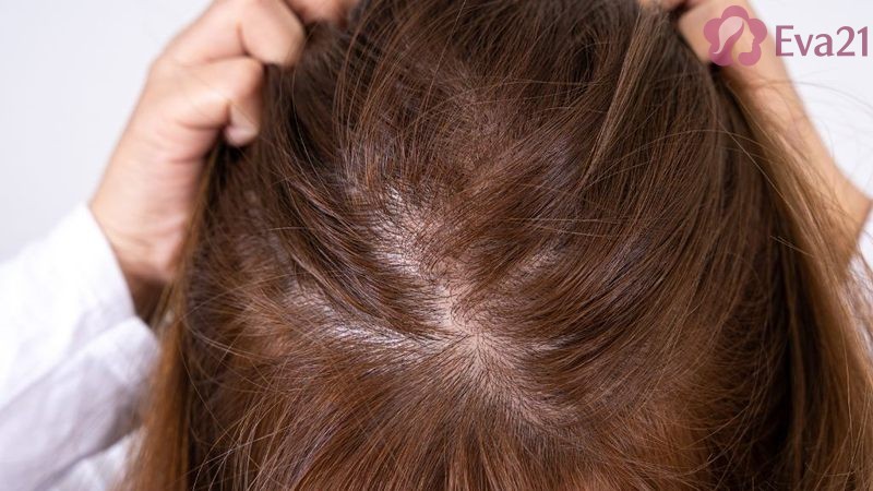 Những nguyên nhân cgaay nên tình trạng ít tóc
