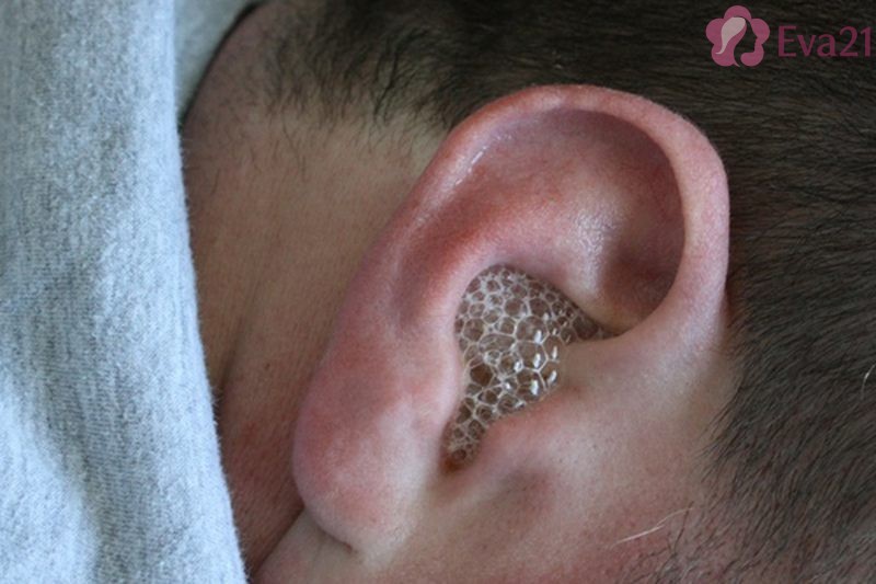 Những mẹo chữa viêm tai giữa bằng sáp ong hiệu quả nhất