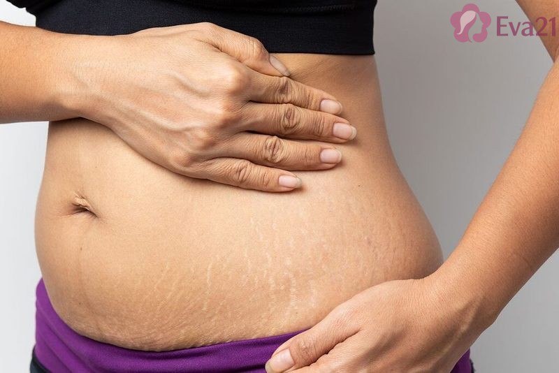 Thực hiện thay đổi cách chăm sóc và bảo vệ da theo từng giai đoạn thai kỳ